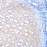 Immunohistochemistry - Anti-CD168 Antibody [ARC0667] (A80858) - Antibodies.com