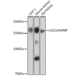 Western Blot - Anti-CD13 Antibody [ARC0670] (A80859) - Antibodies.com