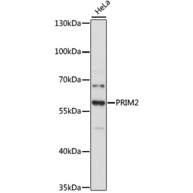 Western Blot - Anti-PRIM2 Antibody (A80860) - Antibodies.com
