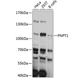 Western Blot - Anti-PNPT1 Antibody (A80861) - Antibodies.com