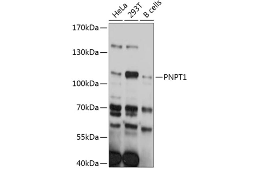 Western Blot - Anti-PNPT1 Antibody (A80861) - Antibodies.com