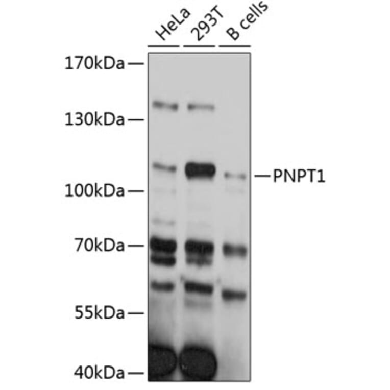 Western Blot - Anti-PNPT1 Antibody (A80861) - Antibodies.com