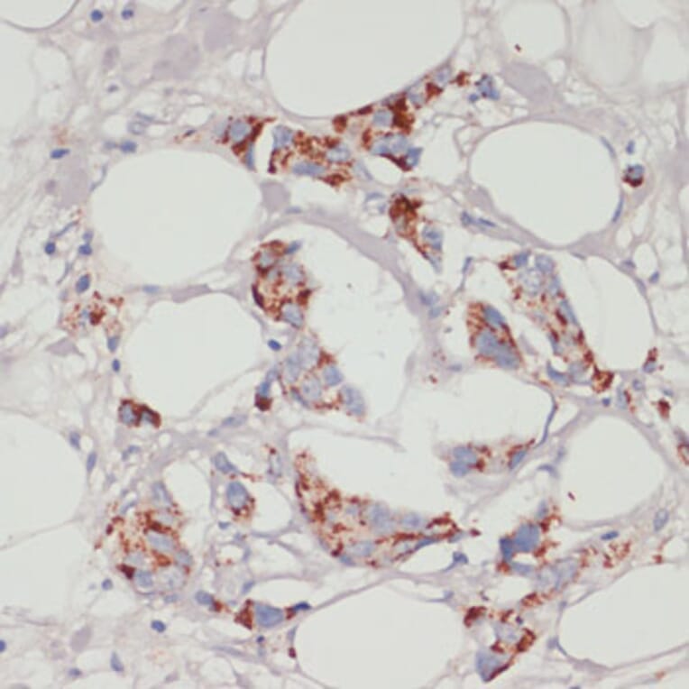 Immunohistochemistry - Anti-ACSL3 Antibody (A80862) - Antibodies.com