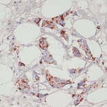 Immunohistochemistry - Anti-ACSL3 Antibody (A80862) - Antibodies.com