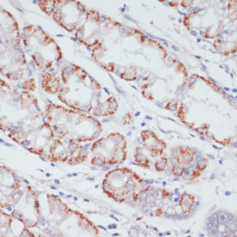 Immunohistochemistry - Anti-ACSL3 Antibody (A80862) - Antibodies.com