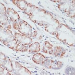 Immunohistochemistry - Anti-ACSL3 Antibody (A80862) - Antibodies.com