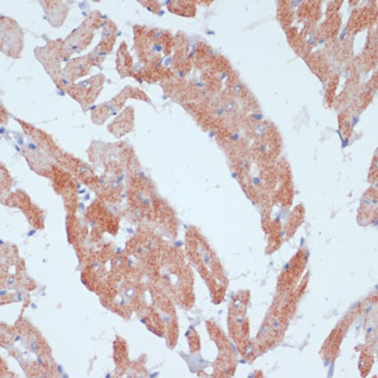 Immunohistochemistry - Anti-ACSL3 Antibody (A80862) - Antibodies.com