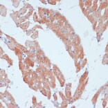 Immunohistochemistry - Anti-ACSL3 Antibody (A80862) - Antibodies.com
