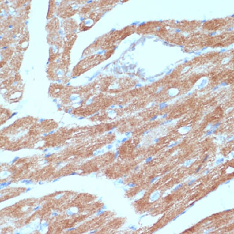 Immunohistochemistry - Anti-ACSL3 Antibody (A80862) - Antibodies.com