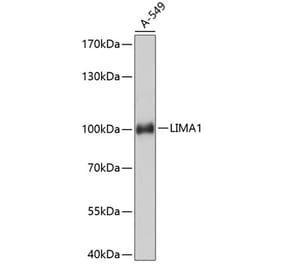 Western Blot - Anti-EPLIN Antibody (A80863) - Antibodies.com