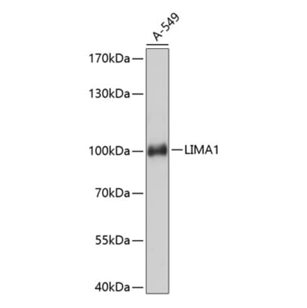 Western Blot - Anti-EPLIN Antibody (A80863) - Antibodies.com