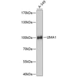 Western Blot - Anti-EPLIN Antibody (A80863) - Antibodies.com