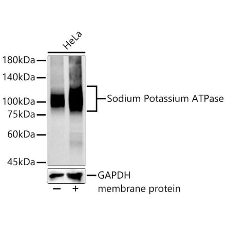 Western Blot - Anti-Sodium Potassium ATPase Antibody [ARC0674] (A80864) - Antibodies.com