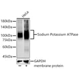 Western Blot - Anti-Sodium Potassium ATPase Antibody [ARC0674] (A80864) - Antibodies.com