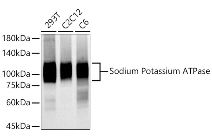 Western Blot - Anti-Sodium Potassium ATPase Antibody [ARC0674] (A80864) - Antibodies.com