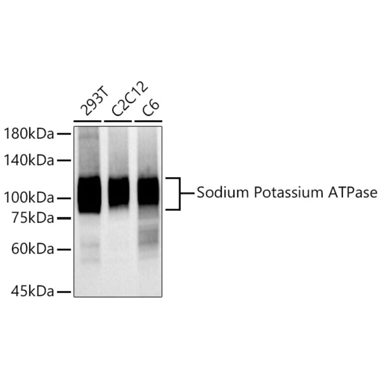 Western Blot - Anti-Sodium Potassium ATPase Antibody [ARC0674] (A80864) - Antibodies.com
