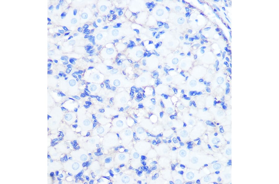 Immunohistochemistry - Anti-Sodium Potassium ATPase Antibody [ARC0674] (A80864) - Antibodies.com