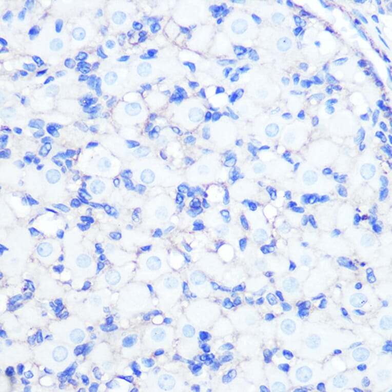 Immunohistochemistry - Anti-Sodium Potassium ATPase Antibody [ARC0674] (A80864) - Antibodies.com