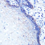 Immunohistochemistry - Anti-Sodium Potassium ATPase Antibody [ARC0674] (A80864) - Antibodies.com