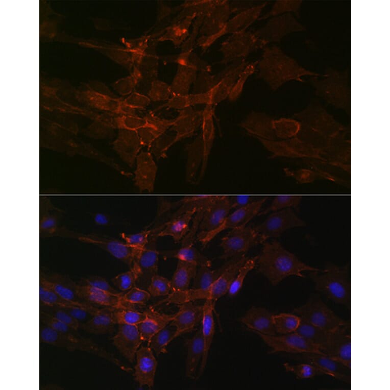 Immunofluorescence - Anti-Sodium Potassium ATPase Antibody [ARC0674] (A80864) - Antibodies.com