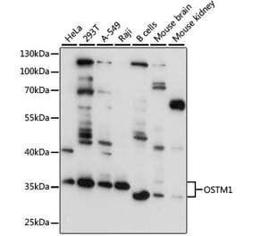 Western Blot - Anti-OSTM1 Antibody (A80865) - Antibodies.com
