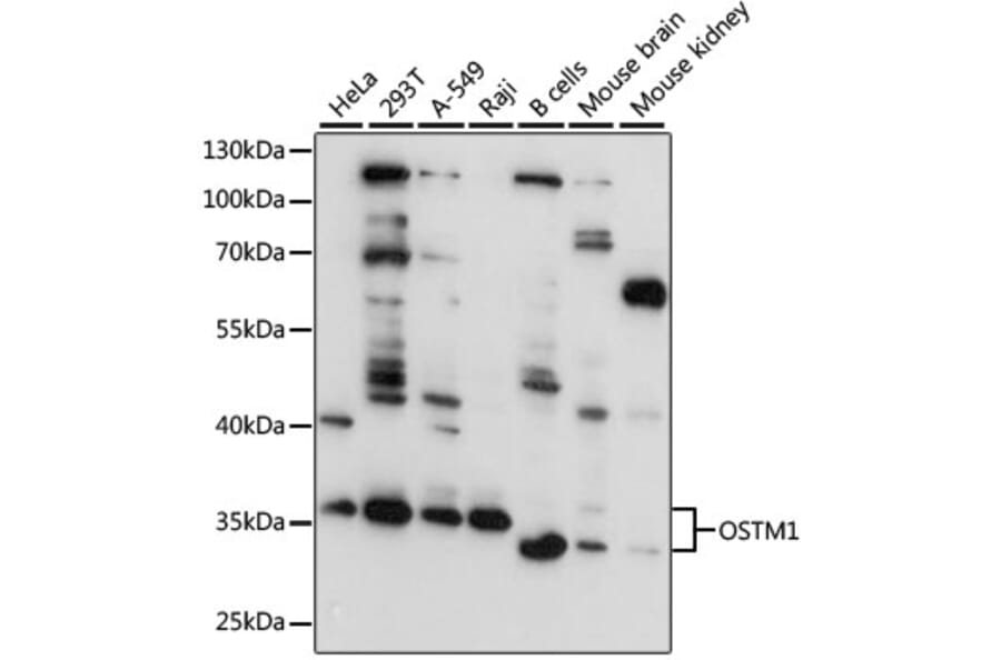 Western Blot - Anti-OSTM1 Antibody (A80865) - Antibodies.com