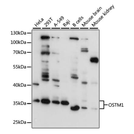 Western Blot - Anti-OSTM1 Antibody (A80865) - Antibodies.com