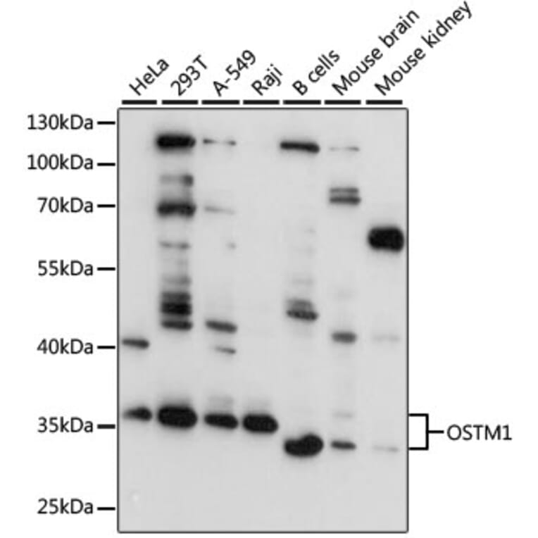 Western Blot - Anti-OSTM1 Antibody (A80865) - Antibodies.com