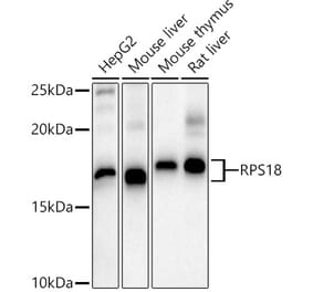 Western Blot - Anti-RPS18 Antibody (A80866) - Antibodies.com