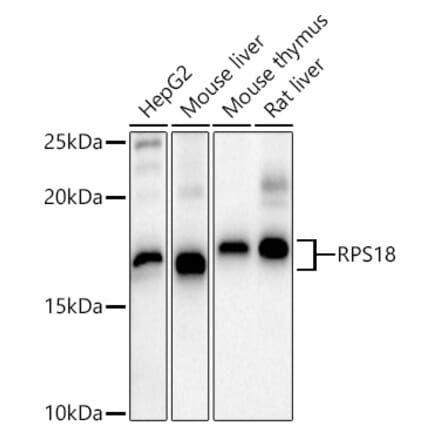 Western Blot - Anti-RPS18 Antibody (A80866) - Antibodies.com