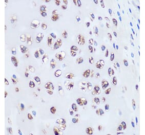 Immunohistochemistry - Anti-Aggrecan Antibody [ARC0678] (A80867) - Antibodies.com