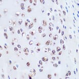 Immunohistochemistry - Anti-Aggrecan Antibody [ARC0678] (A80867) - Antibodies.com