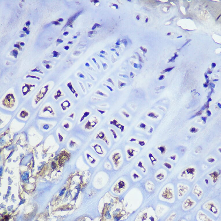 Immunohistochemistry - Anti-Aggrecan Antibody [ARC0678] (A80867) - Antibodies.com