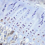 Immunohistochemistry - Anti-Aggrecan Antibody [ARC0678] (A80867) - Antibodies.com