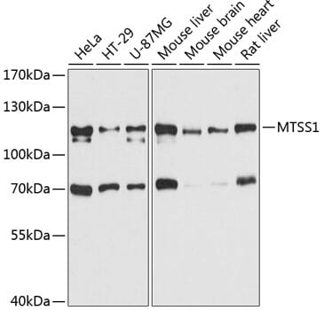 Western blot analysis of extracts of various cell lines, using Anti-MTSS1 Antibody (A11697) at 1:3000 dilution.
Secondary antibody: Goat Anti-Rabbit IgG (H+L) (HRP) (AS014) at 1:10,000 dilution.
Lysates / proteins: 25µg per lane.
Blocking buffer: 3% non-fat dry milk in TBST.
Detection: ECL Basic Kit (RM00020).
Exposure time: 10s.