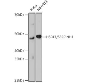 Western Blot - Anti-Hsp47 Antibody [ARC0681] (A80870) - Antibodies.com