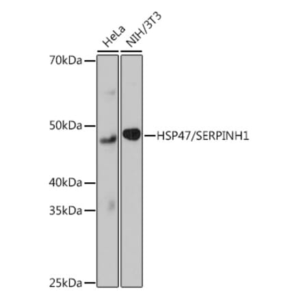 Western Blot - Anti-Hsp47 Antibody [ARC0681] (A80870) - Antibodies.com