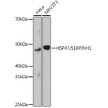 Western Blot - Anti-Hsp47 Antibody [ARC0681] (A80870) - Antibodies.com