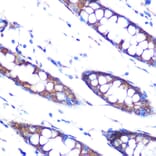 Immunohistochemistry - Anti-Hsp47 Antibody [ARC0681] (A80870) - Antibodies.com