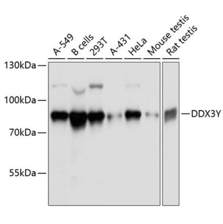 Western Blot - Anti-DDX3Y Antibody (A80871) - Antibodies.com