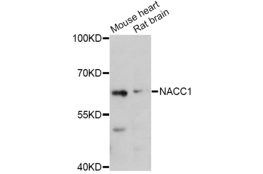 Western Blot - Anti-NACC1 Antibody (A11709) - Antibodies.com