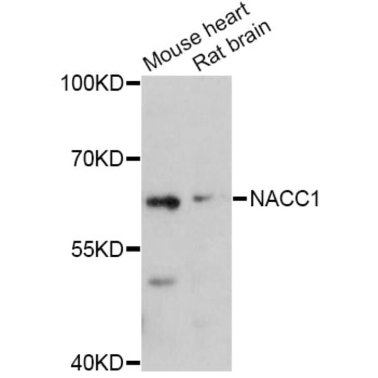 Western Blot - Anti-NACC1 Antibody (A11709) - Antibodies.com
