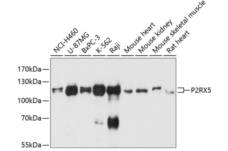 Western Blot - Anti-P2X5 Antibody (A80873) - Antibodies.com
