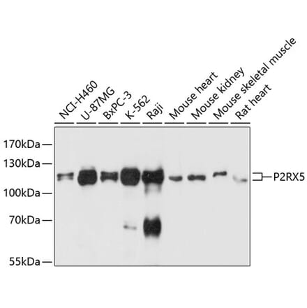 Western Blot - Anti-P2X5 Antibody (A80873) - Antibodies.com