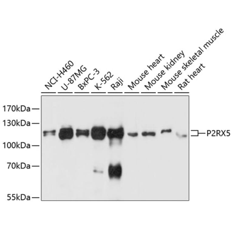 Western Blot - Anti-P2X5 Antibody (A80873) - Antibodies.com