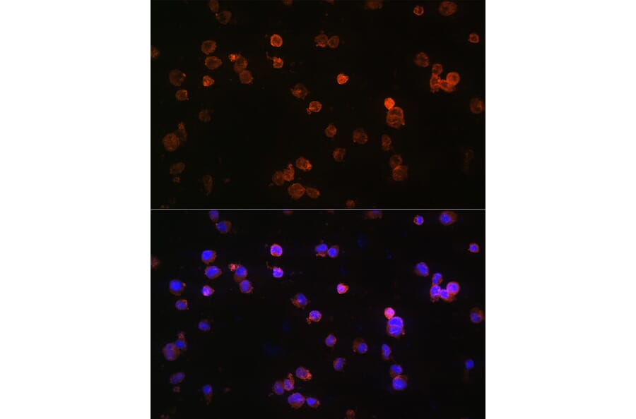 Immunofluorescence - Anti-P2X5 Antibody (A80873) - Antibodies.com