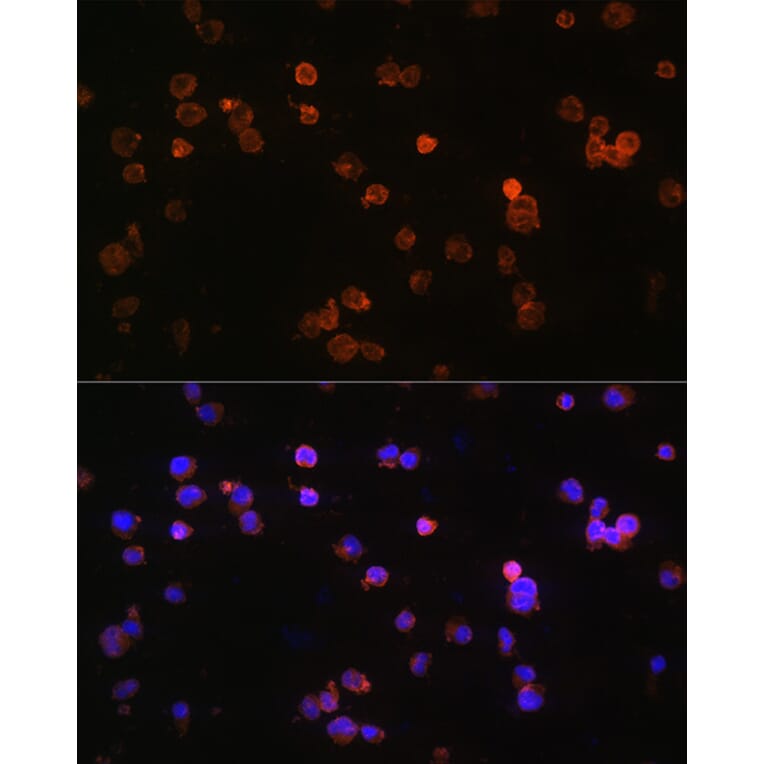 Immunofluorescence - Anti-P2X5 Antibody (A80873) - Antibodies.com