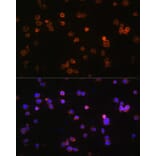 Immunofluorescence - Anti-P2X5 Antibody (A80873) - Antibodies.com