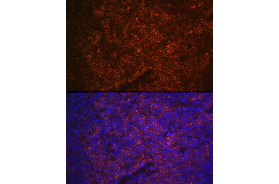 Immunofluorescence - Anti-P2X5 Antibody (A80873) - Antibodies.com