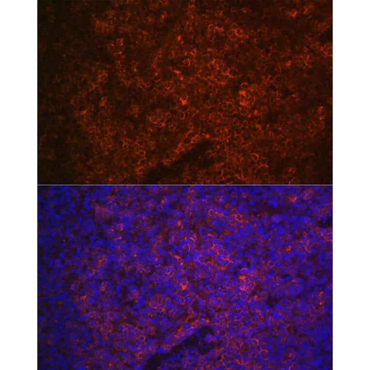 Immunofluorescence - Anti-P2X5 Antibody (A80873) - Antibodies.com